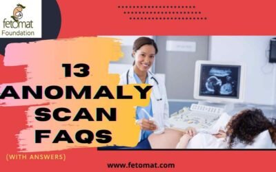 Know 13 Anomaly Scan FAQs (With Answers)
