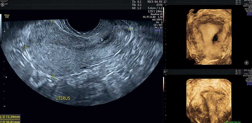 gynecology ultrasound near me