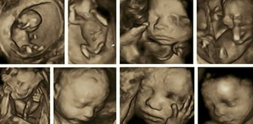 4d pregnancy ultrasonography in kolkata