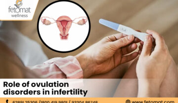 ovulation disorders in infertility