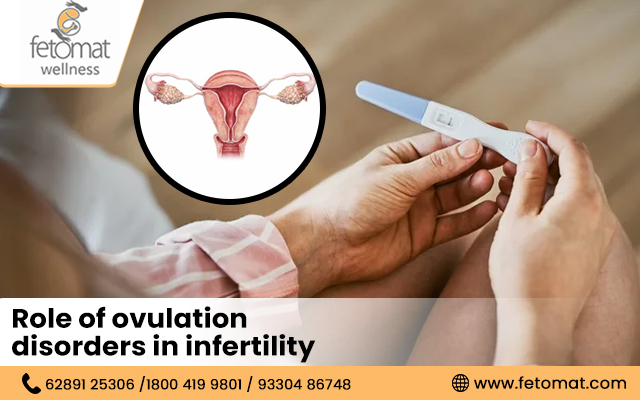 ovulation disorders in infertility