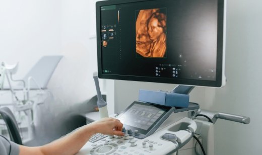 4D Ultrasound Scan 4D Ultrasound Scan
