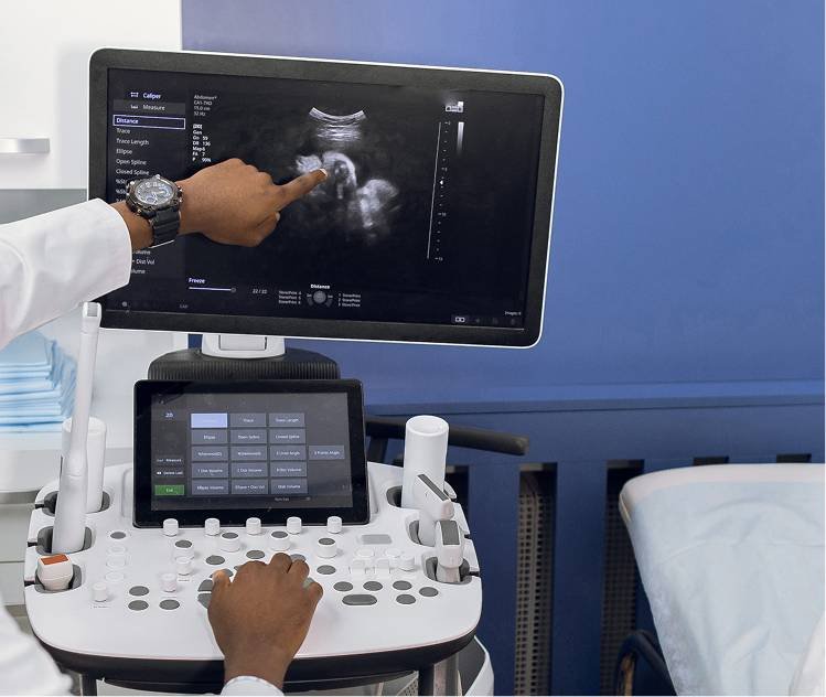 Increased NT Measurement