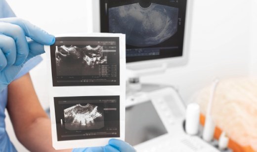 Fetal Anomaly Scan-complicated Fetal Anomaly Scan-complicated