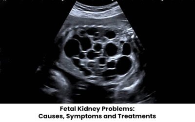 Fetal Kidney Problems: Causes, Symptoms and Treatments