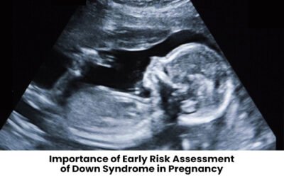 Importance of Early Risk Assessment of Down Syndrome in Pregnancy