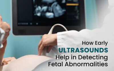 How Early Ultrasounds Help in Detecting Fetal Abnormalities