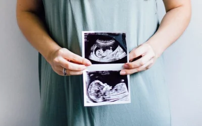 Low-Lying Placenta, Twins, or High-Risk Pregnancy: How Ultrasound Helps Monitor Everything