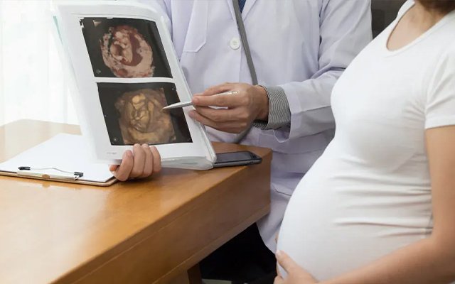 Pregnancy ultrasound